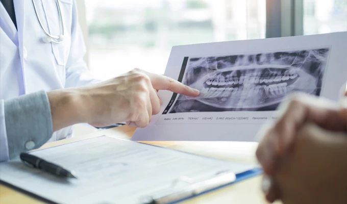 Person pointing to a panoramic dental X-ray during a consultation, with paperwork visible on a desk.